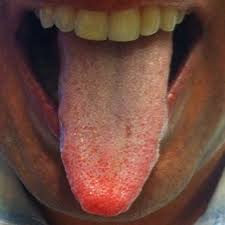 Todo sobre la Lengua